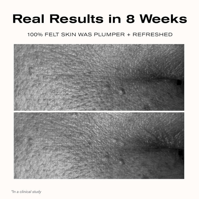 Real Results in 8 Weeks
100% felt skin was plumper + refreshed