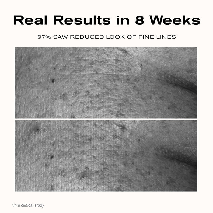 Real Results in 8 weeks
97% saw reduced look of fine lines