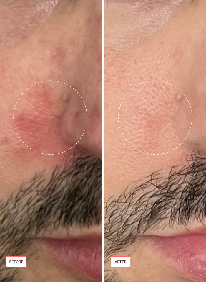 Rescue Party Barrier Restore Serum