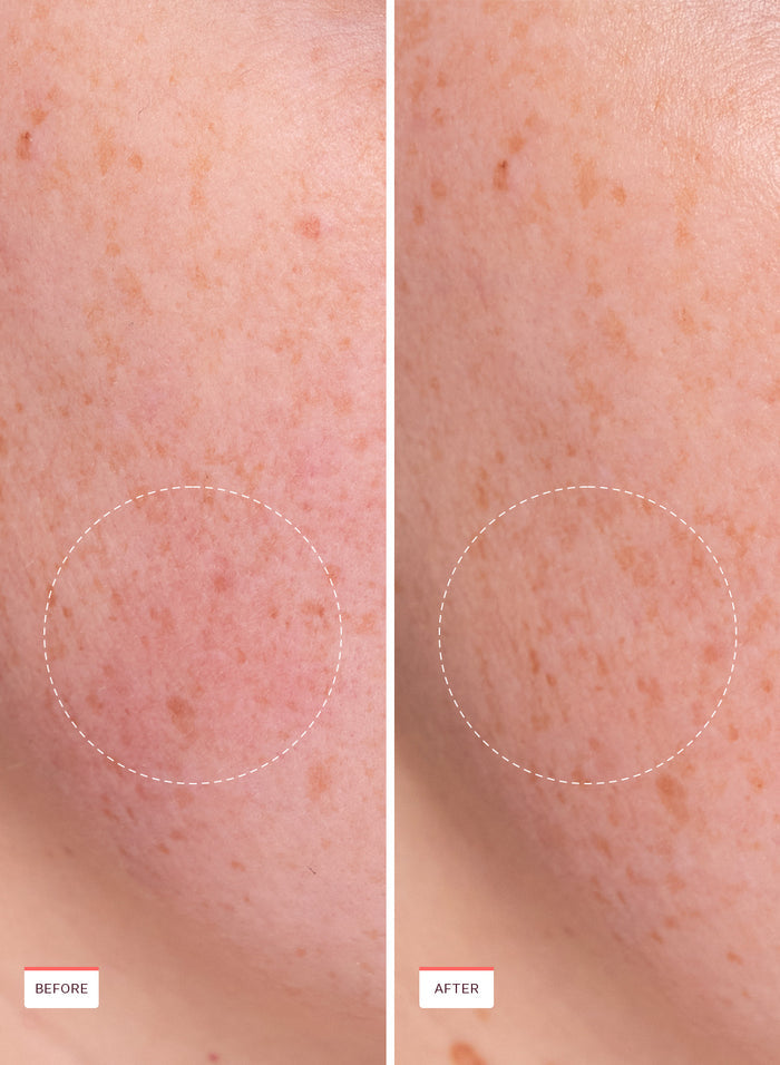 Rescue Party Barrier Restore Serum