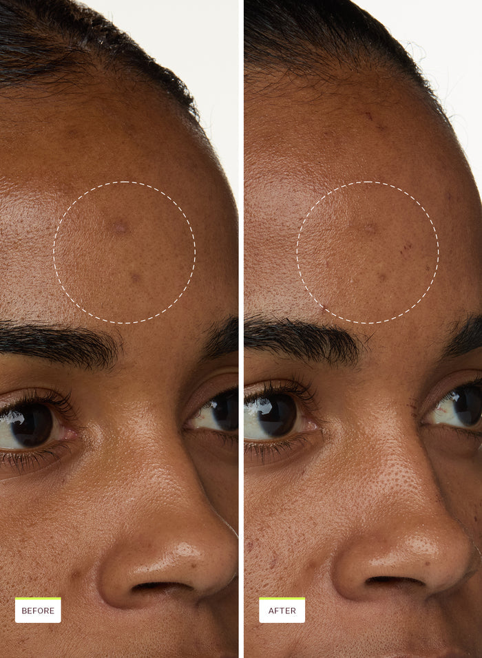 Super Fade Discoloration Duo