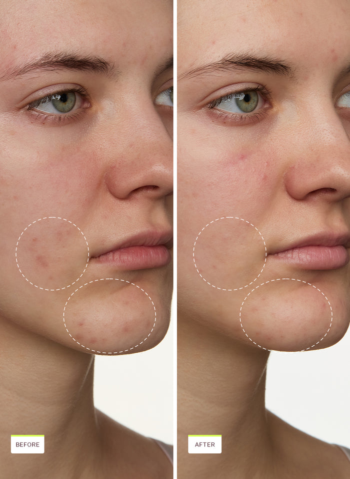 Super Fade Discoloration Duo