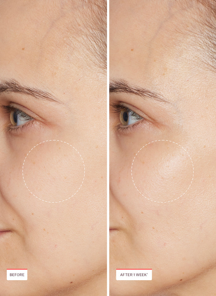 Super Oasis Concentrated Serum