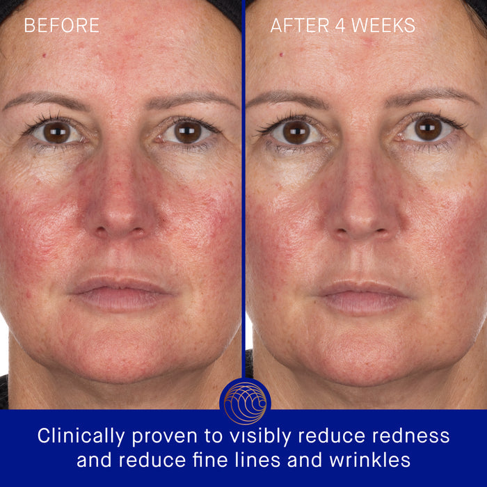 Augustinus Bader The Hydrogel Face Mask